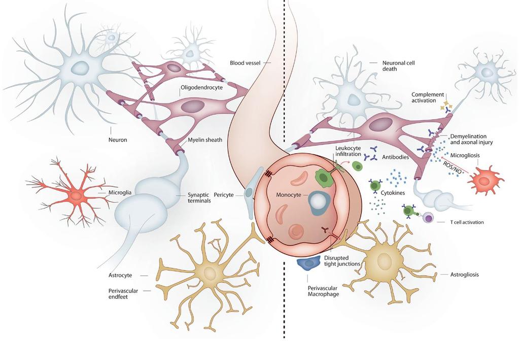 Microglia: an amasing keeper of the brain Healthy brain Damaged brain Neuronal survival/apoptosis