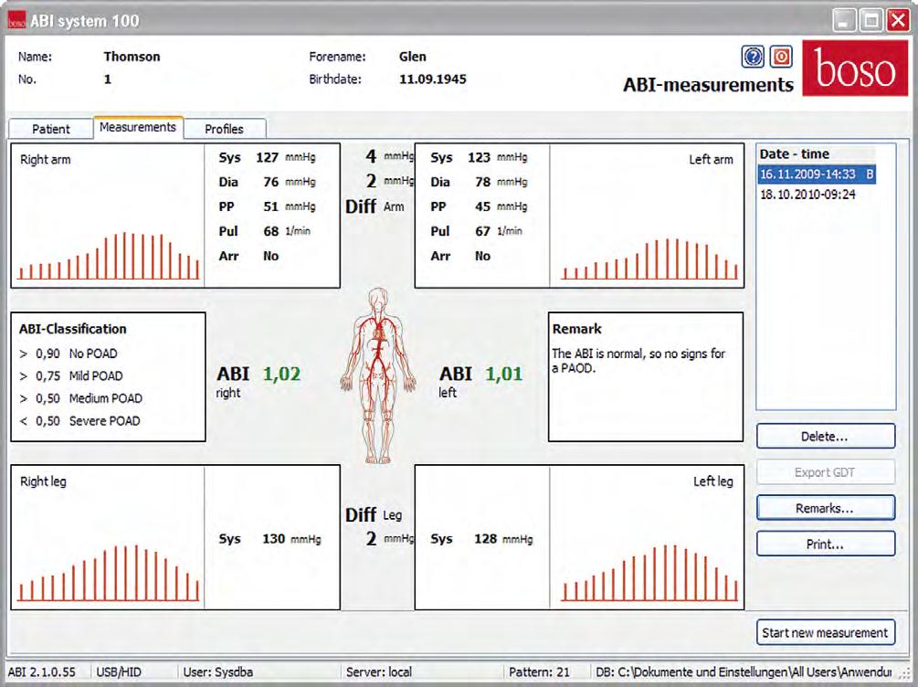 boso ABI software Automatic calculation of many important pieces of data Side-to-side difference (subclavian