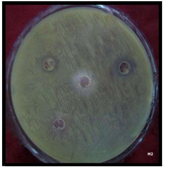 mg/ml.4.65.79 Escherichia coli.42.5.8.42.76.6.95. M.38.6. Streptococcus pyogenes.38.5.45.63.