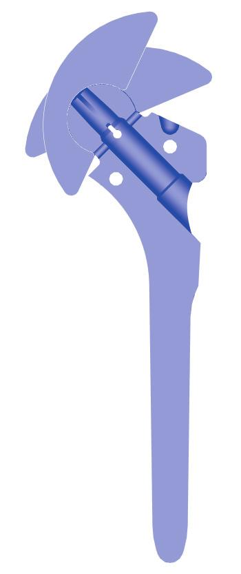 In order to reconstruct the proximal humerus anatomically it is necessary to reproduce the size and orientation of the humeral head accurately.
