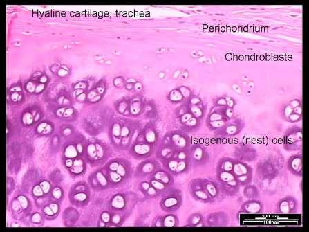 Hyaline Cartilage The most abundant type of cartilage.