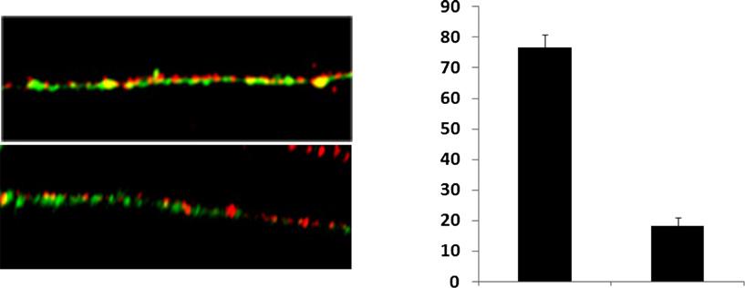 Control RacN17 Cofilin/Flag-TrkA Cofilin positive Flag-TrkA punctae (%) Control RacN17 Figure 6.