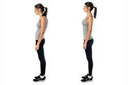 Postural Impairments Posture can have a direct effect on respiratory cycle Subtle changes in posture, even in just one plane, changes the configuration of all three