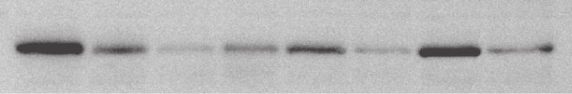 C321 with sham. There was no significant change in total p70s6k protein expression at any time after DNV.