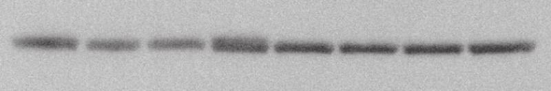 DNV-induced changes in phosphorylation of AMPK, as detected by Western analyses. Top: representative immunoblot of phospho-ampk, AMPK, and -tubulin for each DNV time point.