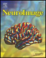 NeuroImage 47 (2009) 1797 1808 Contents lists available at ScienceDirect NeuroImage journal homepage: www.elsevier.