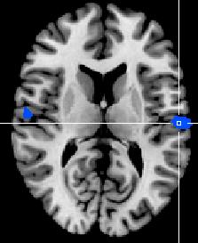 Anterior cingulate cortex A B -8.