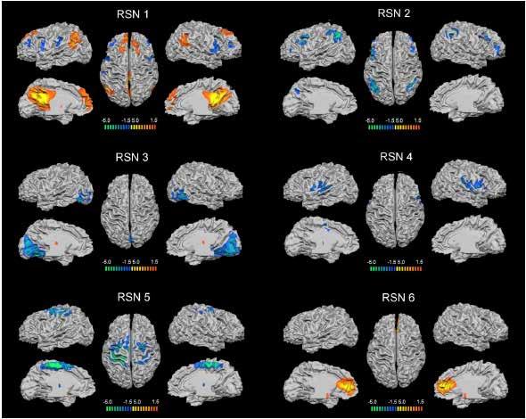 Resting State Network (RSN) Default mode network associated with internal processing Executive network mediating goal-directed stimulus-response selection Visual network dedicated to visual