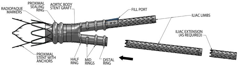 1. Device Description The TriVascular Ovation Prime Abdominal Stent Graft System with the Ovation ix Iliac Stent Graft is an endovascular device delivered via a small diameter catheter to treat