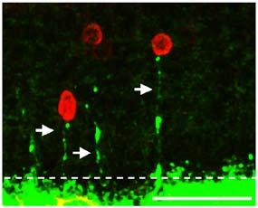 () Rod xons retrted in LKB1 mutnts, Ampkα1α2/AAV2/5-Cre nimls nd old mie, s visulized y sprse infetion with AAV2/5GFP. Sle r represents 5 µm.