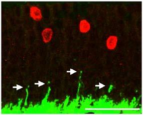 Rods (GFP), green; rod ipolr ells (PKCα), red.