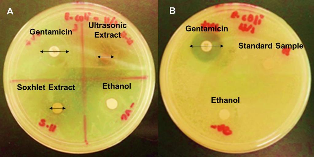 Zone of Inhibition (mm) Rasha Saad et al. / Comparative Study between Fig. 1: Effects of hibiscus extracts (A) and hibiscus standard (B) on Escherichia coli Fig.