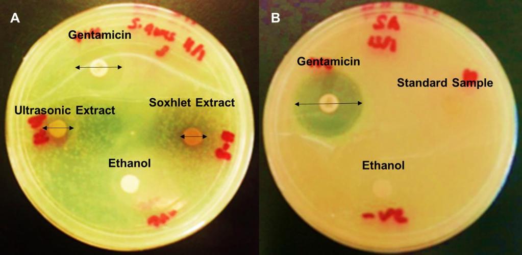 Gentamicin (+ve) Ethanol (-ve) Hibiscus Tea Soxhlet Ultrasonic Escherichia coli 17... 6. 7. Staphylococcus aureus 17... 8. 11. 2 15 1 5 Comparison of Soxhlet and Ultrasonic Extracts of Hibiscus on E.