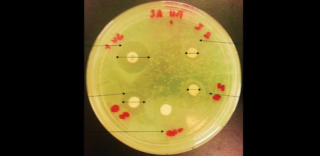 [2] Test Microorganisms: Escherichia coli and Staphylococcus aureus were obtained from Faculty of Health and Life Science of Management and Science University (MSU), Malaysia.