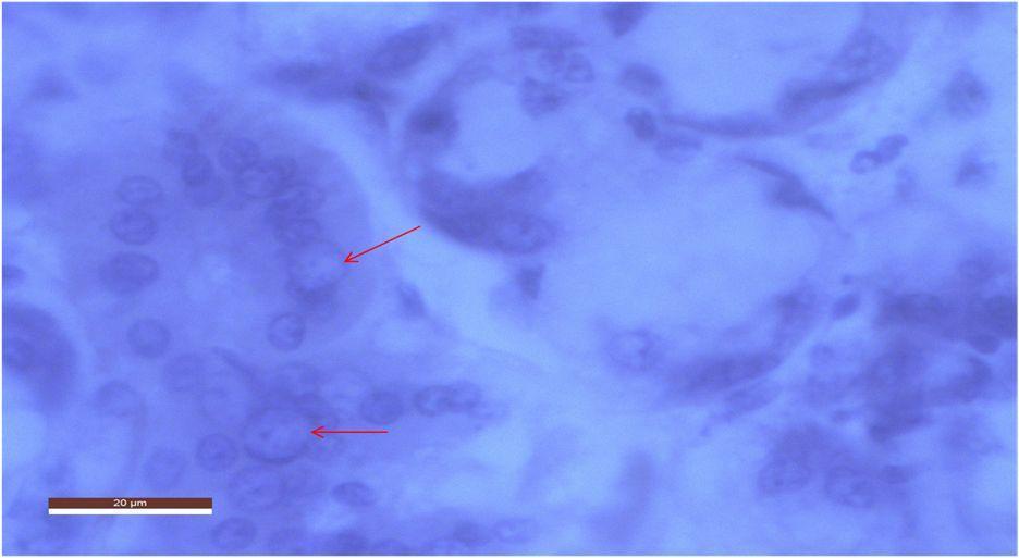 Figure 7: T.S of Thyroid Gland of Rat Treated with 300mg/kg bw/day of Sodium Fluoride Showing Some Inflammatory Cells in the Epithelial Lining of the Follicles; H&E x 1000 Figure 8: T.