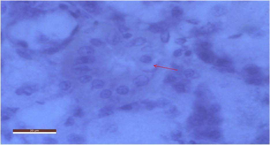 Cells are Large, Cuboidal having Rounded Nuclei with an Extensive Vacuolated Cytoplasm; H&E x 1000 Group III The thyroid gland of rat treated with 600mg/kg bw/day of sodium fluoride showed fusion of