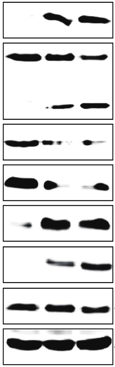 Lee TH et al. Apoptosis of Nasal Polyp Induced by Dexamethasone 115 1 FasL Bid tbid Bcl-2 2. Bcl-XL Bax p-bad Protein fold induction 1.5 Bad.5 FasL Bid tbid Bcl-2 Bcl-XL Bax p-bad Bad Fig. 2. Western blot analysis for FasL, Bcl-2, Bcl-XL, Bax, Bad, p-bad, Bid, and tbid.