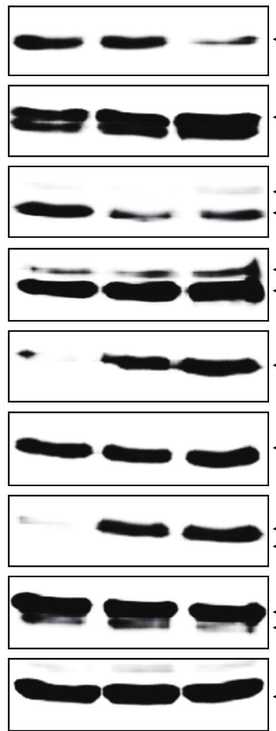 Lee TH et al. Apoptosis of Nasal Polyp Induced by Dexamethasone 117 1 1 p-akt Akt 2. p-erk1/2 ERK1/2 p-p38 MAPK p38 MAPK Protein fold induction 1.5 p-jnk.