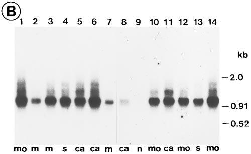 were detected to a lesser extent Figure 2. Analysis of CD44-mRNA in colorectal cancer by RT-PCR and Southern blot hybridization.