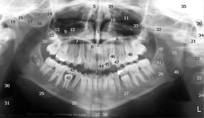 A) Allan G. Farman (2007) remarks 50 distinct soft tissues, bony and dental landmarks on a normal panoramic radiograph.