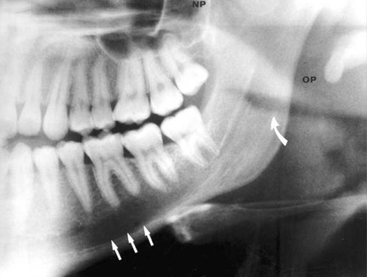 As mentioned above, the strategy for the interpretation of a panoramic radiograph is varies according to various and subjective factors.