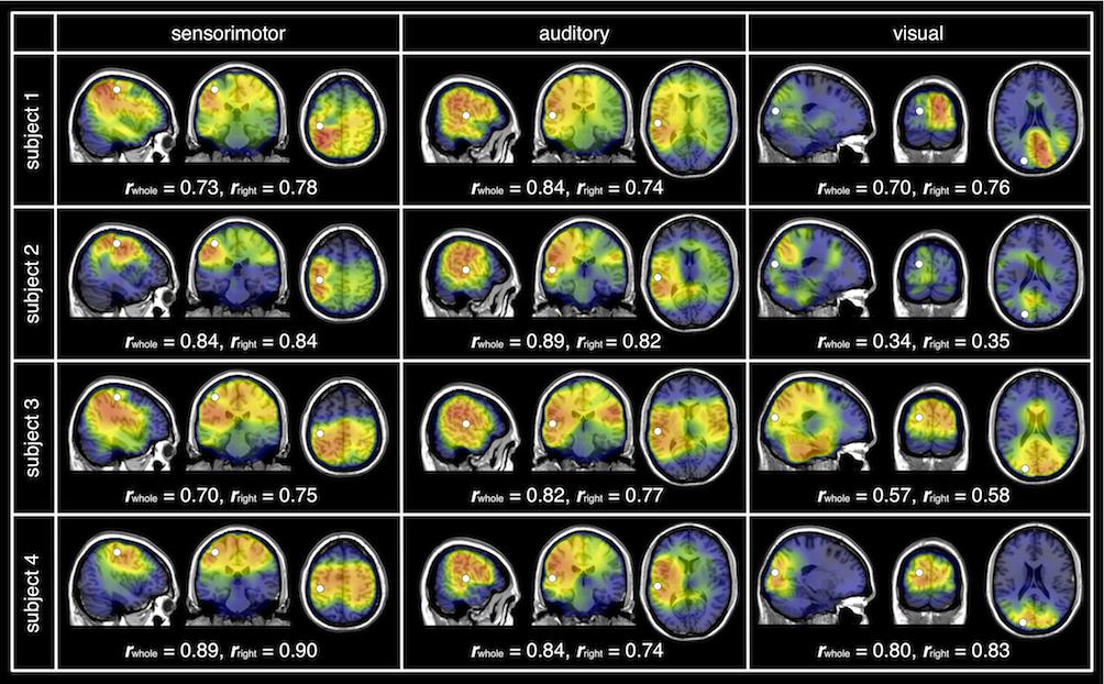 Inter- and Intra-Subject Variability of Neuromagnetic Resting State Networks 9 Fig.