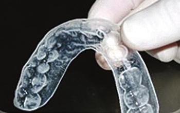 vacuum forming materials vacuum forming materials Mouthguard Material Coloured f e at u r e s: 5" x 5" clear sheets Anterior Brace Mechanism Soft for energy absorption Great for athletic mouthguards,