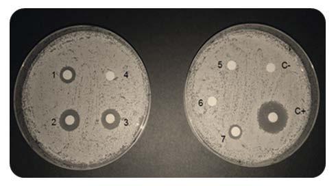 C. albicans is differently affected by mouthwashes 47 Protocol C = mature biofilm (48 h-old biofilm + MoWs): 48 h-old biofilms were exposed to the MoWs (1:2, 1:4, 1:16, 1:32, 1:64 dilutions) for 1,