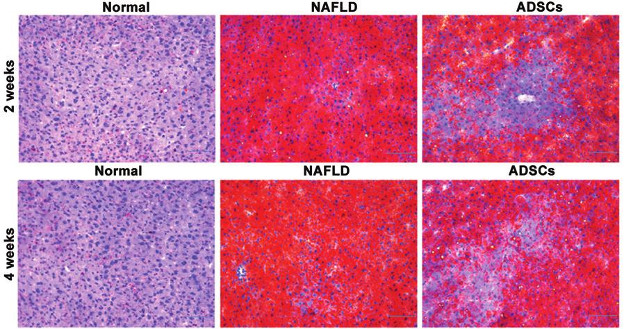 3730 PN et al: INTRHEPTIC TRNSPLNTTION OF DSCs TTENUTES PROGRESSION OF NFLD IN RTS Figure 5. Hepatic pathological changes following DSC transplantation.