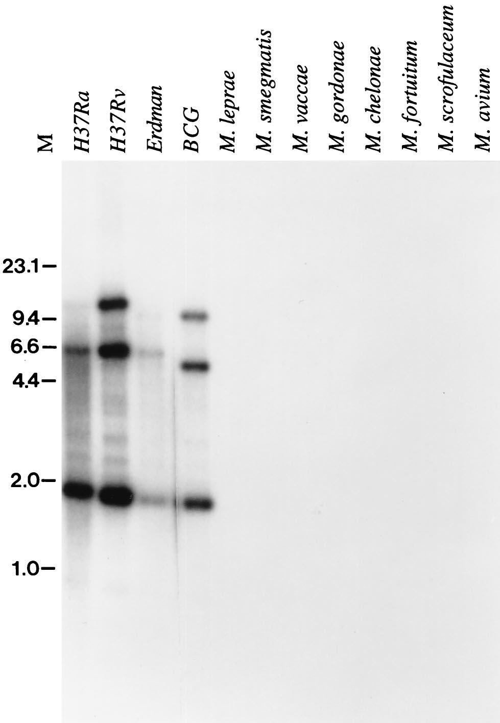 2944 DILLON ET AL. INFECT. IMMUN. FIG. 3. Southern blot analysis of mtb39 genes. Genomic DNA (2.