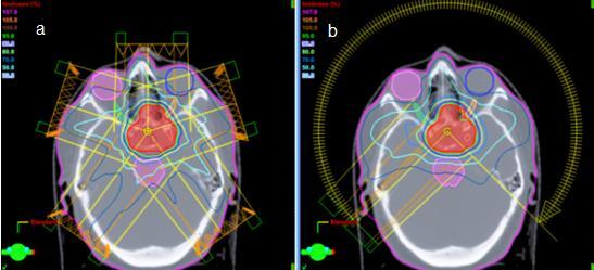 steep and dose delivered to the tumour and critical structures is much more accurately defined.