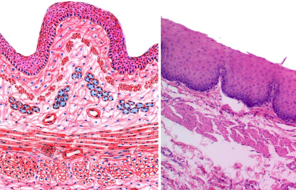 Common structure of the wall of GIT tube The mucosa epithelial linning lamina propria /loose connect.