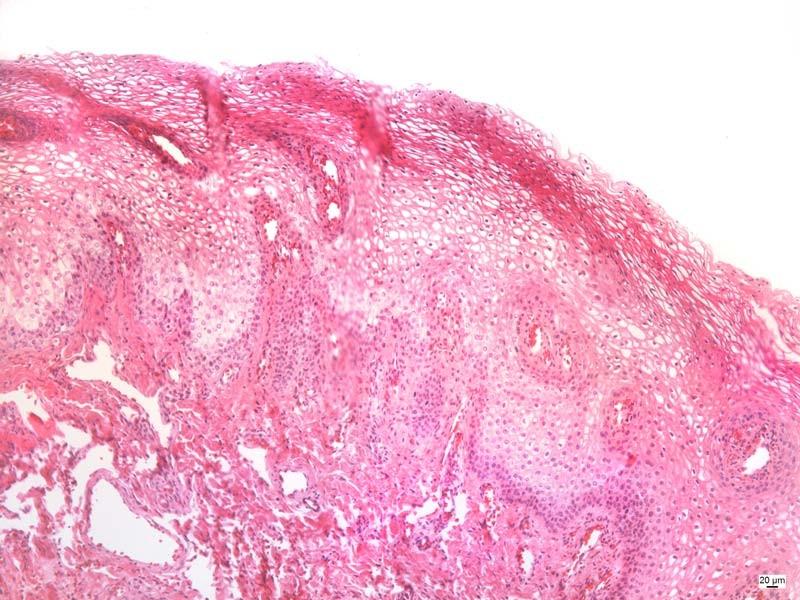 Lips labia eleidin The epithelium is somewhat thicker than in other parts of the facial skin. C.t. papilla extend deep into the epithelium and are heavily vascularized.