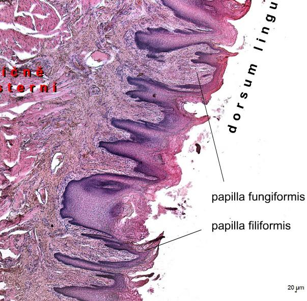 Tongue - dorsal surface The mucosa filiform, fungiform, circumvallatae,