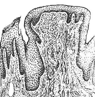 ) aponeurosis linguae - inferior surface (mylohyoidea) The mucosa without