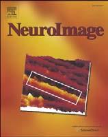 NeuroImage xxx (2010) xxx xxx YNIMG-07309; No. of pages: 14; 4C: 8, 9, 10, 11 Contents lists available at ScienceDirect NeuroImage journal homepage: www.elsevier.