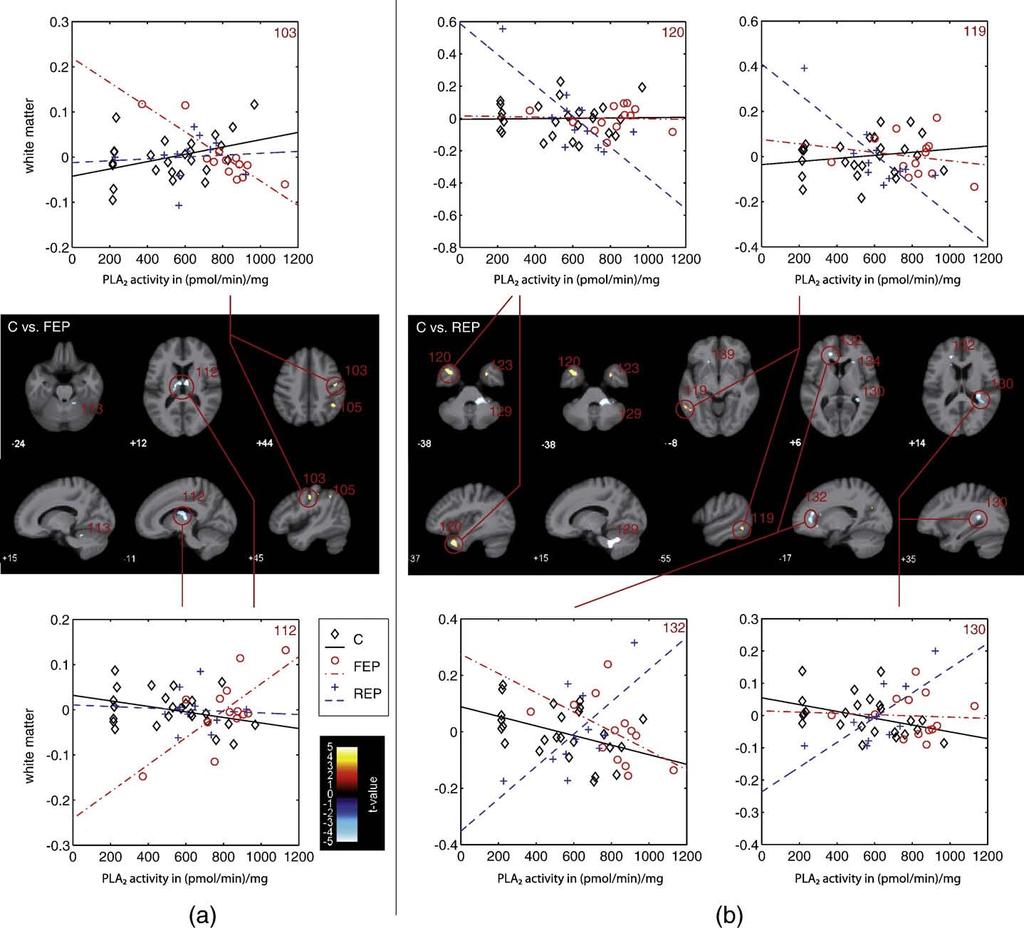 10 S. Smesny et al. / NeuroImage xxx (2010) xxx xxx Fig. 4. Presentation of VBM-based pair-wise group comparison of associations between PLA 2 activity and white matter. This figure shows the FEP vs.