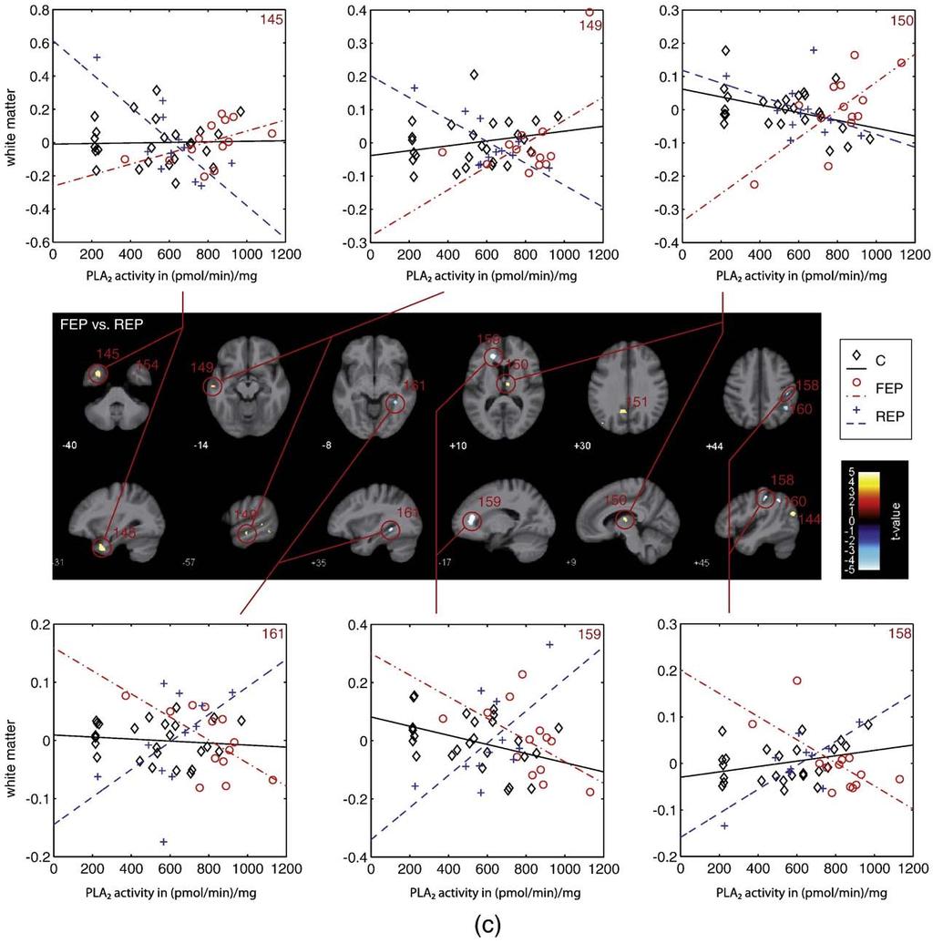 S. Smesny et al. / NeuroImage xxx (2010) xxx xxx 11 Fig. 5. Presentation of VBM-based pair-wise group comparison of associations between PLA 2 activity and white matter. This figure shows the FEP vs.
