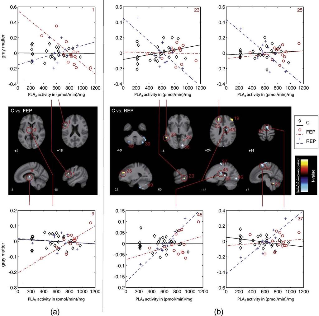 8 S. Smesny et al. / NeuroImage xxx (2010) xxx xxx Fig. 2. Presentation of VBM-based pair-wise group comparison of associations between PLA 2 activity and gray matter. This figure shows the FEP vs.