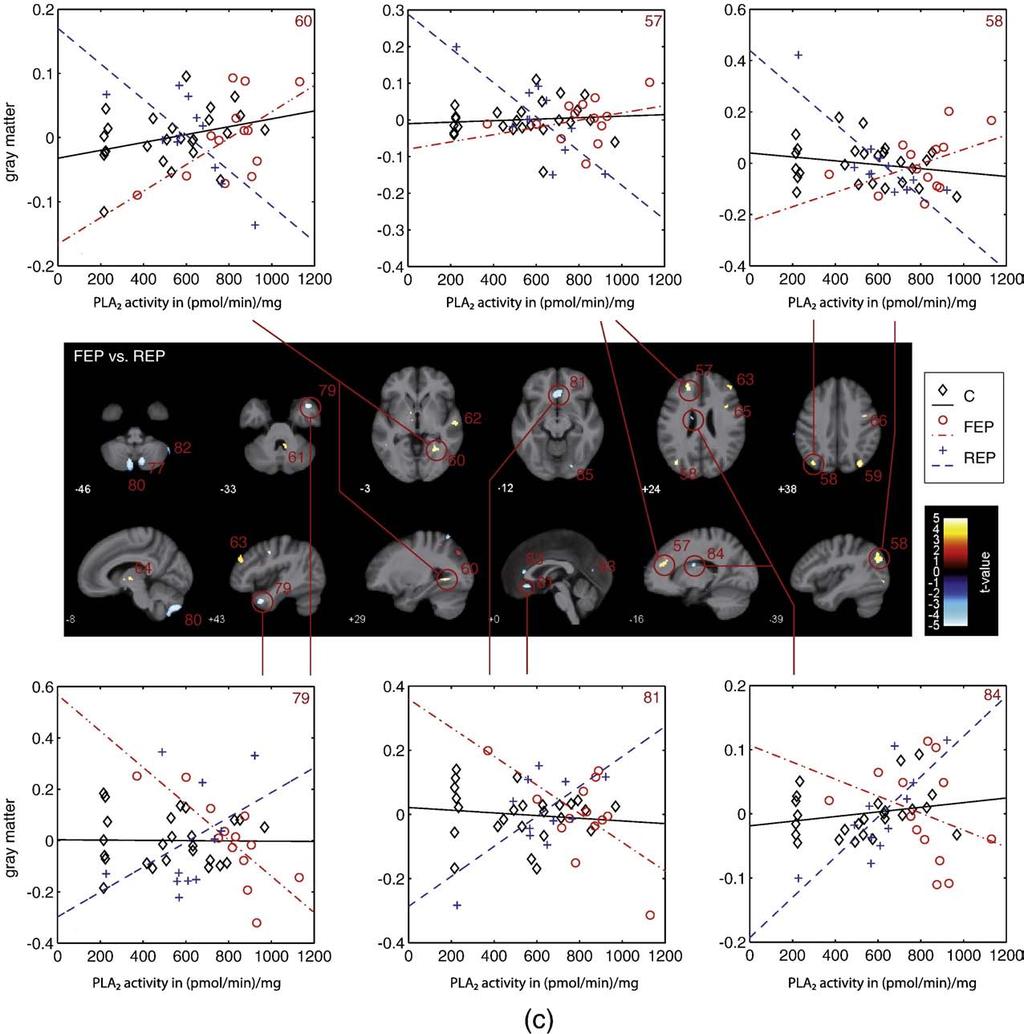 S. Smesny et al. / NeuroImage xxx (2010) xxx xxx 9 Fig. 3. Presentation of VBM-based pair-wise group comparison of associations between PLA 2 activity and gray matter. This figure shows the FEP vs.