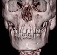 Craniocervical Anatomy and Physiology Hopper, Salemy, and Sze 2006 Osseous and