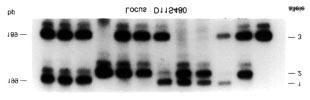 The PCR amplification products were separated on a polyacrylamide gel and detected by autoradiography (lower panel); these ranged in size from 189 to 199 bp.