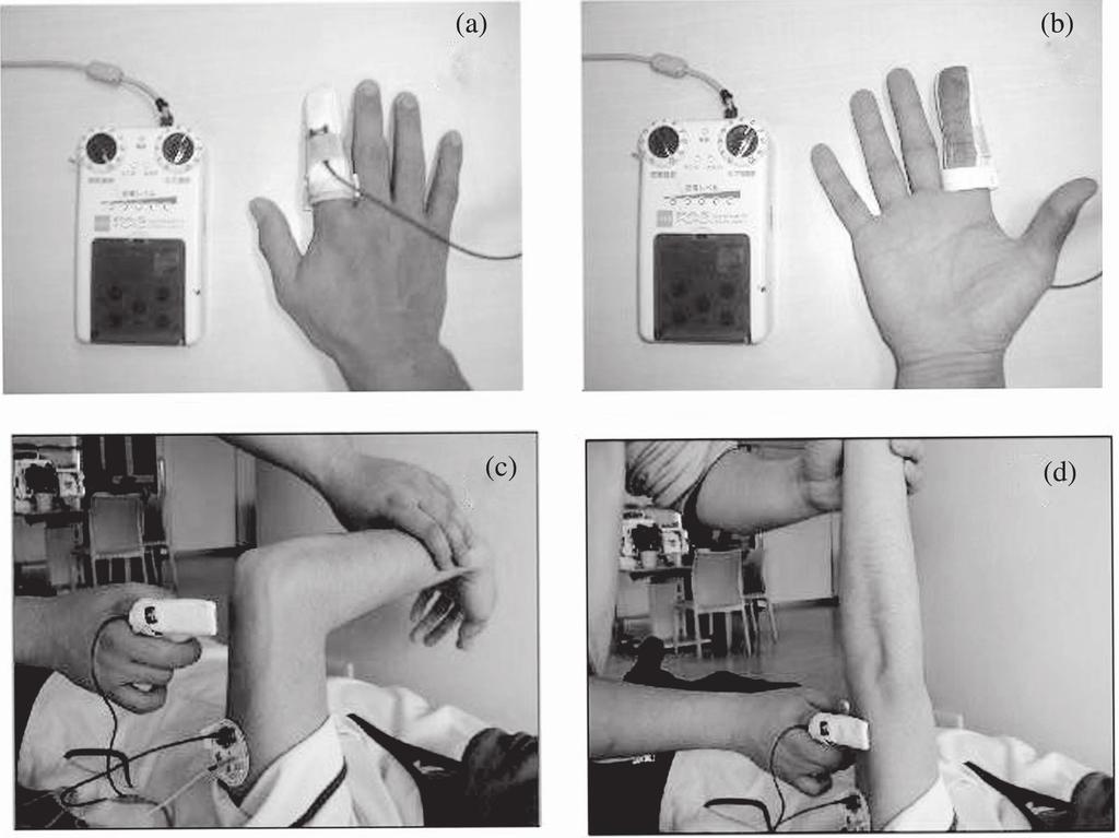 Finger-equipped electrode (FEE) 115 Figure 1. (a, b) Characteristics of the FEE, which is made of metal-coated fabric. (c, d) A treatment session (for elbow extension) using the FEE.