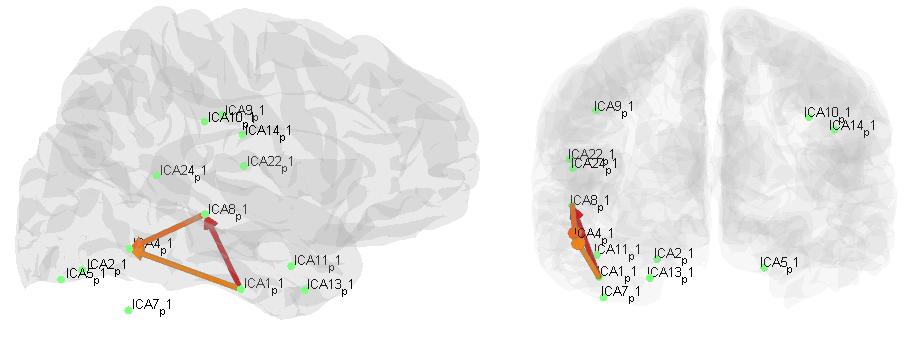 MEG MEG ICA networks L SEEG Malinowska et al, Hum Brain Mapp