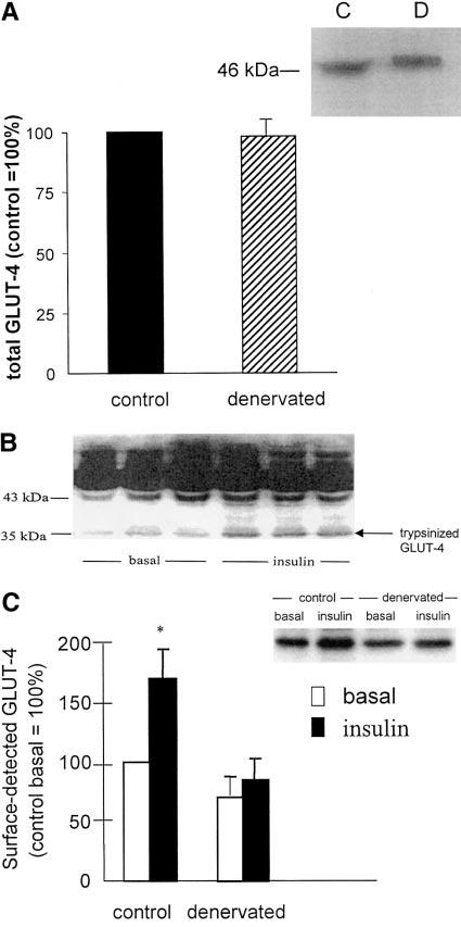 E916 INSULIN RESISTANCE IN 24-HOUR-DENERVATED RAT MUSCLE Fig. 5. Trypsin-accessible surface GLUT-4 and total GLUT-4 in soleus muscle from 24-h-denervated rats.