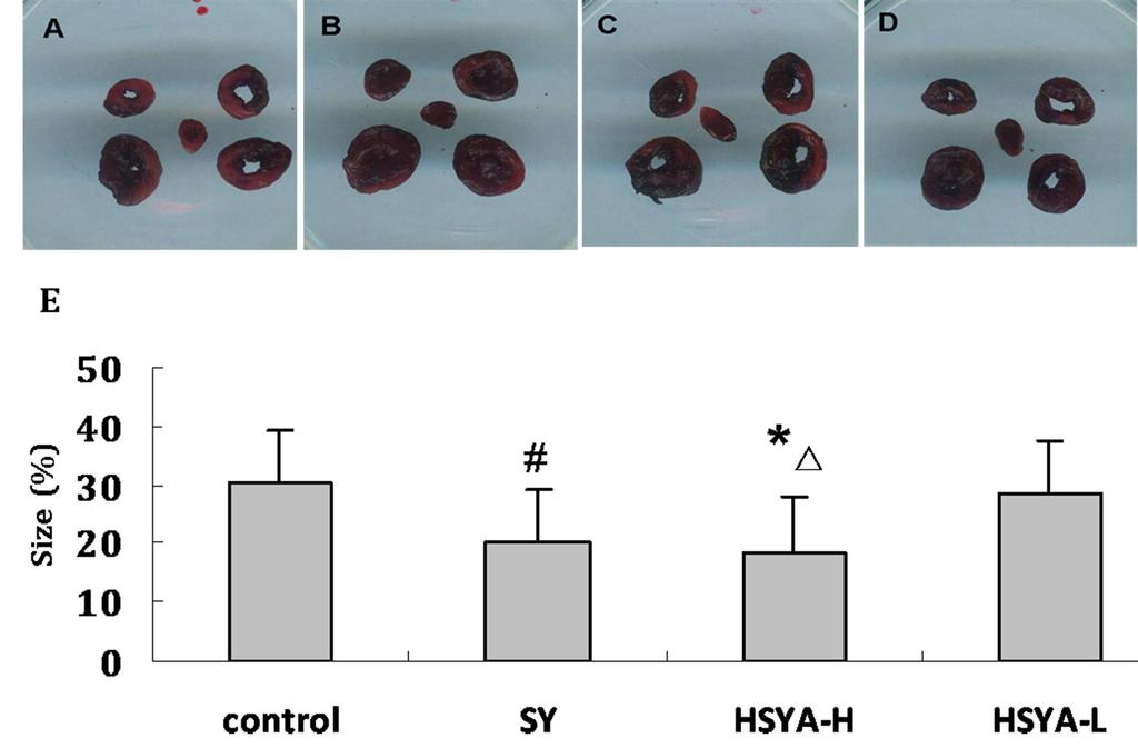 hydroxy safflower A low-dose (HSYA-L) treatment group; E. HSYA high-dose (HSYA-H) treatment group; F. comparison between the ST segments on the ECG of the rats in each group. *P < 0.
