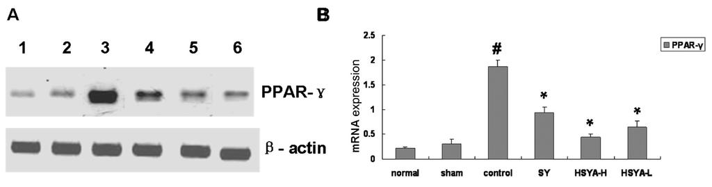 Effect of HSYA on myocardial apoptosis 3139 Effect of HSYA on mrna expression of PPAR-γ in the myocardial tissue of rats mrna expression of PPAR-γ in the myocardial tissue of rats in the control