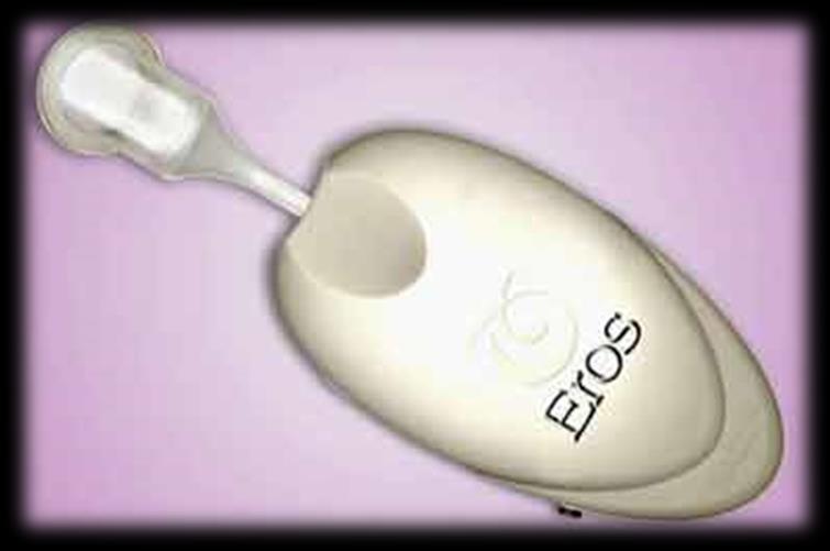 Mechanical aids Vibrators Clitoral therapy device Orgasm