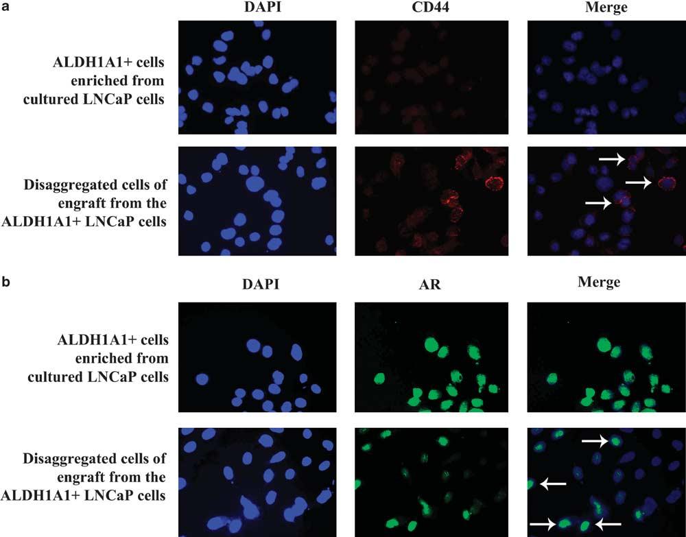 Figure 3 ALDH1A1 þ PCa cells produced heterogeneous populations of tumorigenic phenotypes.