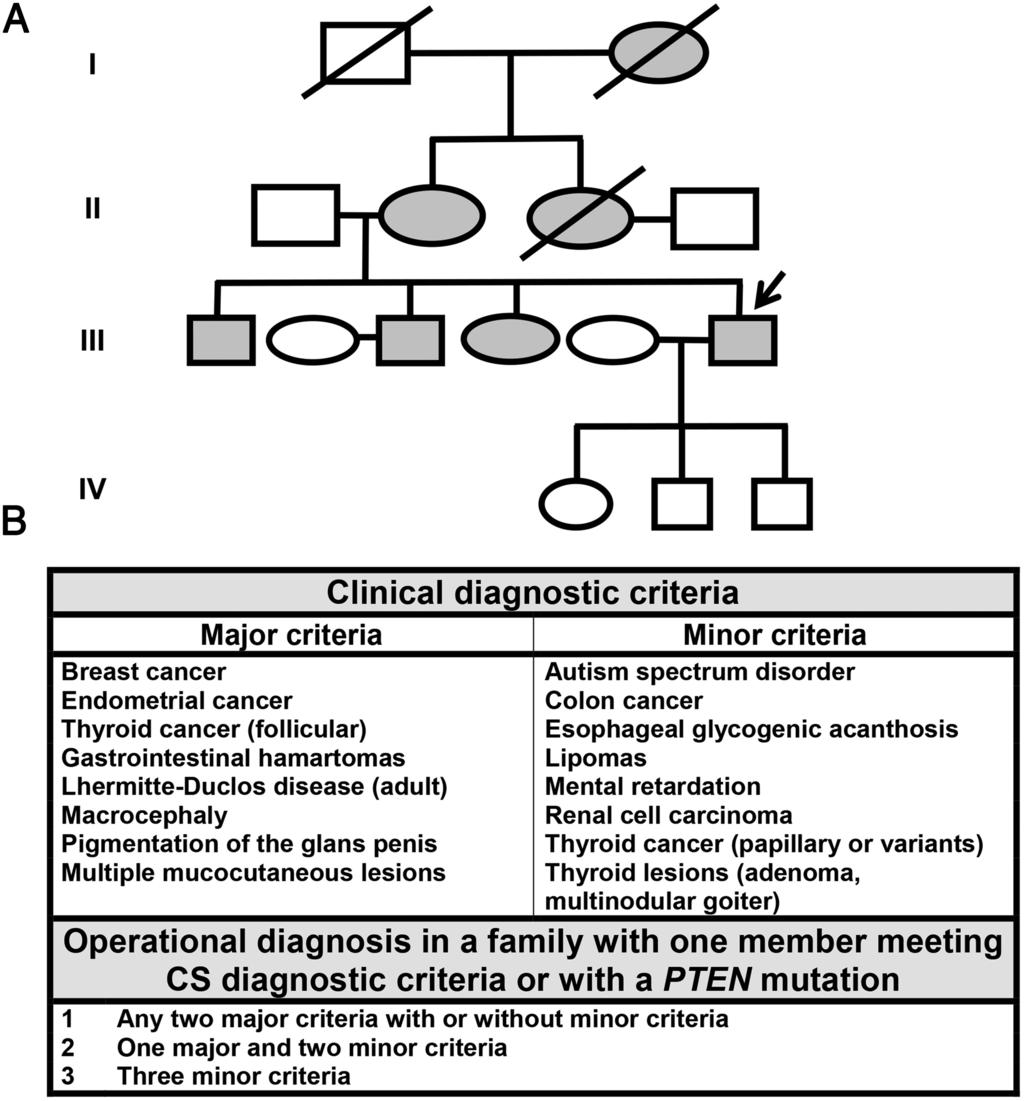 354 Neychev et al Cowden Syndrome and Pancreatic NETs J Clin Endocrinol Metab, February 2016, 101(2):353 358 Figure 1. Pedigree and diagnostic criteria for CS.